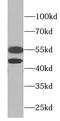 Mitogen-Activated Protein Kinase 8 antibody, FNab04444, FineTest, Western Blot image 
