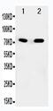 Succinate dehydrogenase [ubiquinone] flavoprotein subunit, mitochondrial antibody, PA5-79963, Invitrogen Antibodies, Western Blot image 