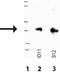 Suppression Of Tumorigenicity 14 antibody, ADI-905-1008-0100, Enzo Life Sciences, Western Blot image 