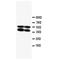 Gap junction alpha-5 protein antibody, orb27581, Biorbyt, Western Blot image 