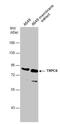 Short transient receptor potential channel 6 antibody, NBP1-31008, Novus Biologicals, Western Blot image 