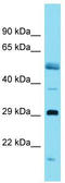 Putative transcription factor Ovo-like 1 antibody, TA342338, Origene, Western Blot image 