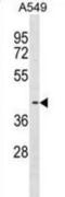 Fatty acid desaturase 3 antibody, abx030156, Abbexa, Western Blot image 