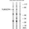 Tubulin Gamma Complex Associated Protein 4 antibody, A11058, Boster Biological Technology, Western Blot image 