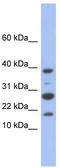 NADH:Ubiquinone Oxidoreductase Subunit C1 antibody, TA337668, Origene, Western Blot image 
