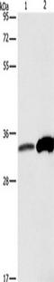 Annexin A4 antibody, TA349236, Origene, Western Blot image 