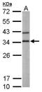 3'(2'), 5'-Bisphosphate Nucleotidase 1 antibody, NBP1-32152, Novus Biologicals, Western Blot image 