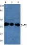 Ceroid-lipofuscinosis neuronal protein 6 antibody, A03538, Boster Biological Technology, Western Blot image 