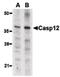 Caspase-12 antibody, PA5-20034, Invitrogen Antibodies, Western Blot image 