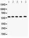 Nuclear Receptor Subfamily 5 Group A Member 2 antibody, PB9298, Boster Biological Technology, Western Blot image 