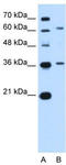 Zinc Finger And SCAN Domain Containing 12 antibody, TA342409, Origene, Western Blot image 