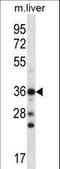 Chromobox 8 antibody, LS-C168368, Lifespan Biosciences, Western Blot image 