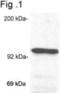 Nuclear Receptor Subfamily 3 Group C Member 1 antibody, NB300-731, Novus Biologicals, Western Blot image 
