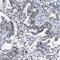 Synaptonemal Complex Central Element Protein 1 antibody, FNab08411, FineTest, Immunohistochemistry paraffin image 