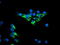 Dihydrolipoamide Dehydrogenase antibody, LS-C173226, Lifespan Biosciences, Immunofluorescence image 