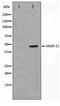 Matrix Metallopeptidase 23B antibody, TA347435, Origene, Western Blot image 