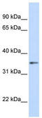 G Protein Subunit Beta 1 antibody, TA335042, Origene, Western Blot image 