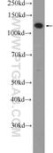 Lysosomal Associated Membrane Protein 1 antibody, 21997-1-AP, Proteintech Group, Western Blot image 