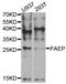 Progestagen Associated Endometrial Protein antibody, TA332886, Origene, Western Blot image 