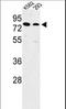 Solute Carrier Family 3 Member 1 antibody, LS-B14764, Lifespan Biosciences, Western Blot image 