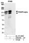 Platelet Derived Growth Factor Receptor Alpha antibody, A700-078, Bethyl Labs, Immunoprecipitation image 