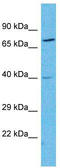 Neuropeptide Y Receptor Y2 antibody, TA329176, Origene, Western Blot image 