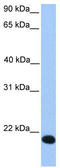 Putative zinc finger protein 833 antibody, TA342137, Origene, Western Blot image 