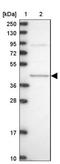 Mevalonate Diphosphate Decarboxylase antibody, NBP2-13628, Novus Biologicals, Western Blot image 