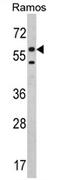 Electron transfer flavoprotein-ubiquinone oxidoreductase, mitochondrial antibody, AP17349PU-N, Origene, Western Blot image 