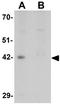 Dolichyl-Phosphate N-Acetylglucosaminephosphotransferase 1 antibody, GTX16275, GeneTex, Western Blot image 