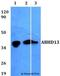 Abhydrolase Domain Containing 13 antibody, LS-C411774, Lifespan Biosciences, Western Blot image 