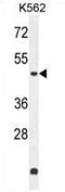 Zinc Finger Protein 572 antibody, AP54664PU-N, Origene, Western Blot image 