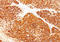 Melan-A antibody, AM50297PU-T, Origene, Immunohistochemistry paraffin image 