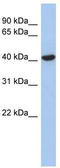 Zinc Finger FYVE-Type Containing 1 antibody, TA339821, Origene, Western Blot image 