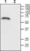 Acetylcholine Receptor antibody, TA328609, Origene, Western Blot image 