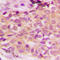 Mitogen-Activated Protein Kinase Kinase Kinase 5 antibody, abx133151, Abbexa, Western Blot image 