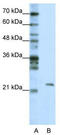 Mitochondrial RRNA Methyltransferase 1 antibody, TA343934, Origene, Western Blot image 