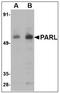 Presenilin Associated Rhomboid Like antibody, AP23960PU-N, Origene, Western Blot image 