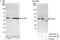 Cyclin Dependent Kinase 9 antibody, A303-493A, Bethyl Labs, Western Blot image 
