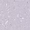 CT-2 antibody, NBP2-39094, Novus Biologicals, Immunohistochemistry paraffin image 