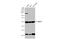 SWI/SNF Related, Matrix Associated, Actin Dependent Regulator Of Chromatin, Subfamily E, Member 1 antibody, GTX106345, GeneTex, Western Blot image 