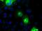Cadherin 13 antibody, MA5-25100, Invitrogen Antibodies, Immunocytochemistry image 