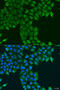 Cyclin Dependent Kinase 16 antibody, 23-427, ProSci, Immunofluorescence image 