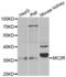 Melanocortin 2 Receptor antibody, abx002183, Abbexa, Western Blot image 