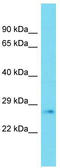 Phospholipase D6 antibody, TA334803, Origene, Western Blot image 