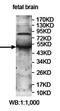 Potassium Channel Tetramerization Domain Containing 16 antibody, orb78143, Biorbyt, Western Blot image 