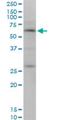 Otopetrin 2 antibody, H00092736-M10, Novus Biologicals, Western Blot image 