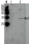 HIV1 gp41 antibody, 65-016, BioAcademia Inc, Western Blot image 