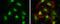 RB Binding Protein 8, Endonuclease antibody, GTX70264, GeneTex, Immunocytochemistry image 
