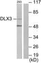 Homeobox protein DLX-3 antibody, TA313754, Origene, Western Blot image 